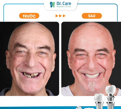 Slider image (3) Dr. Care Implant Clinic